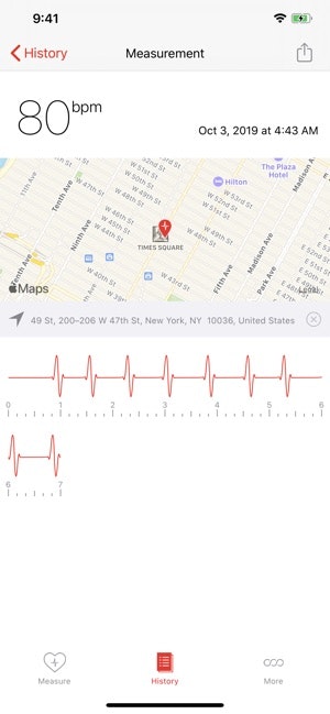 cardiograph game